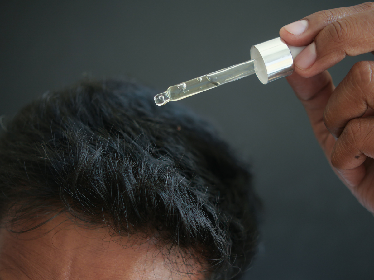 Minoxidil Price Philippines: How Much Does It Cost in 2025? - Andyou.ph