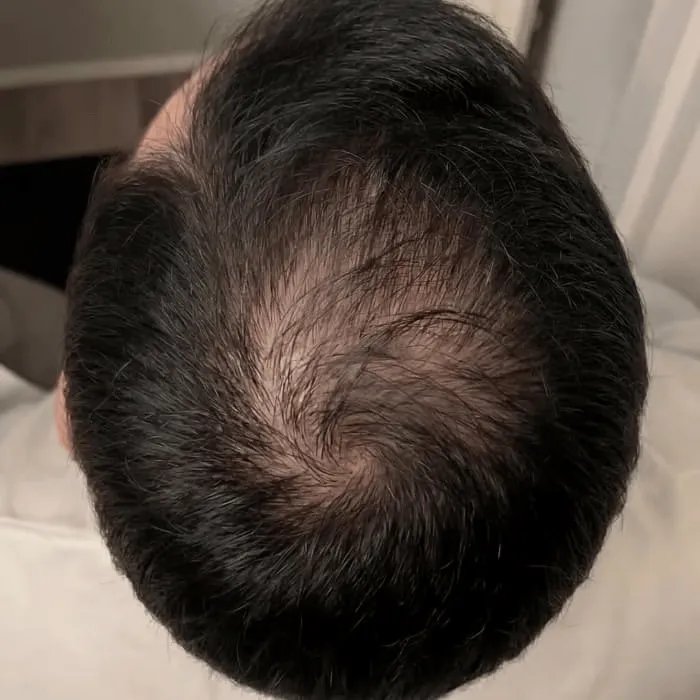 Before