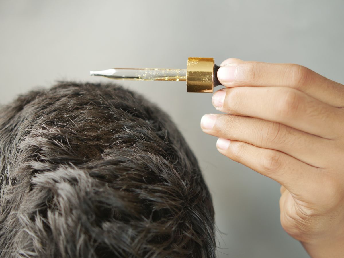 What to Expect: Minoxidil Before and After Hair Growth - andyou.ph