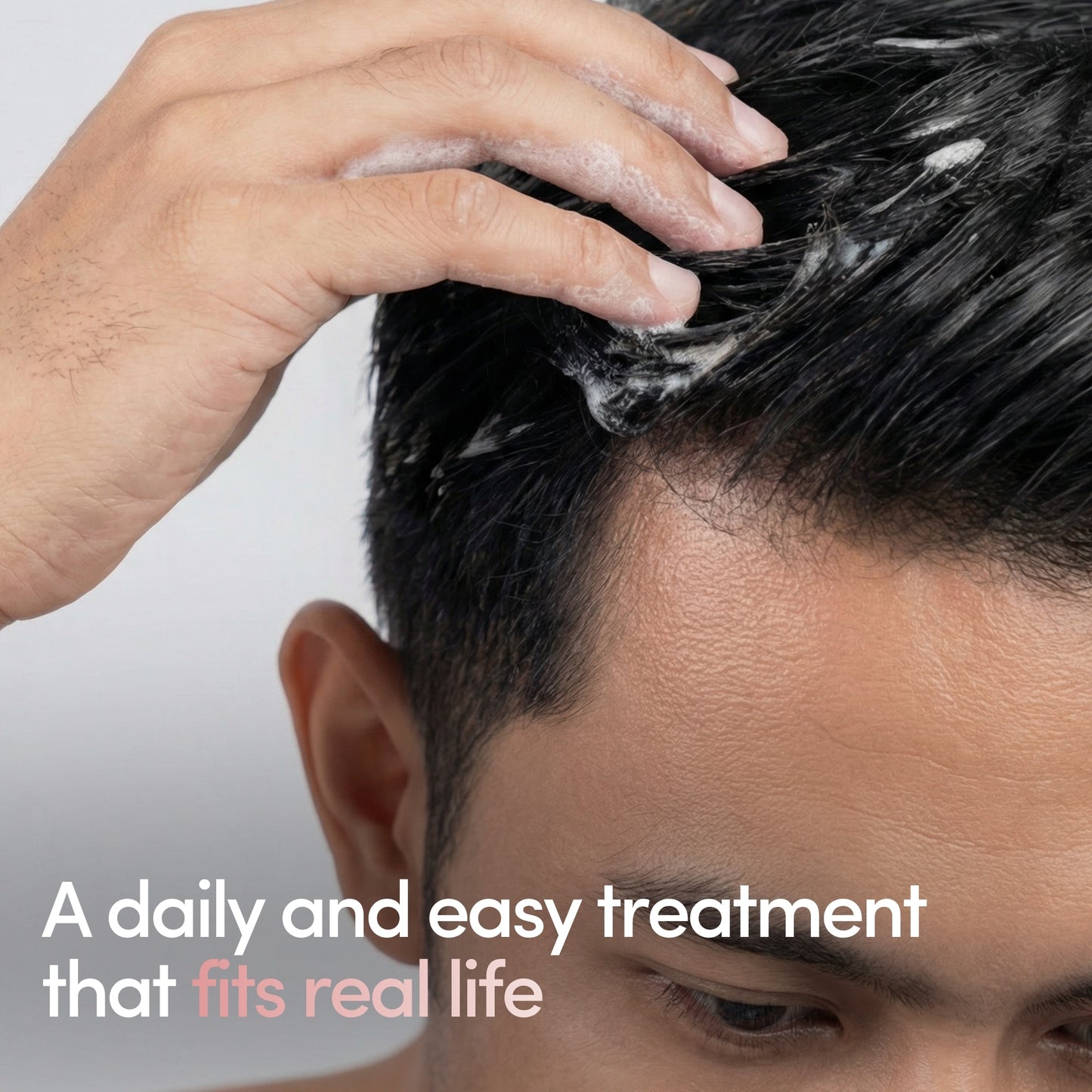 Hair Regrowth Foamʳˣ