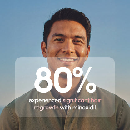 Finasteride + Minoxidil Blendʳˣ